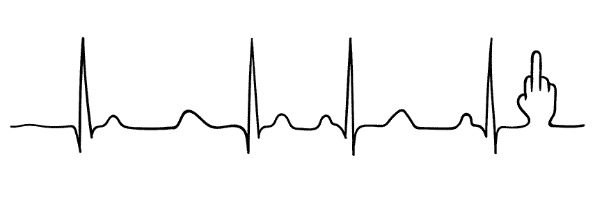 My recent EKG
